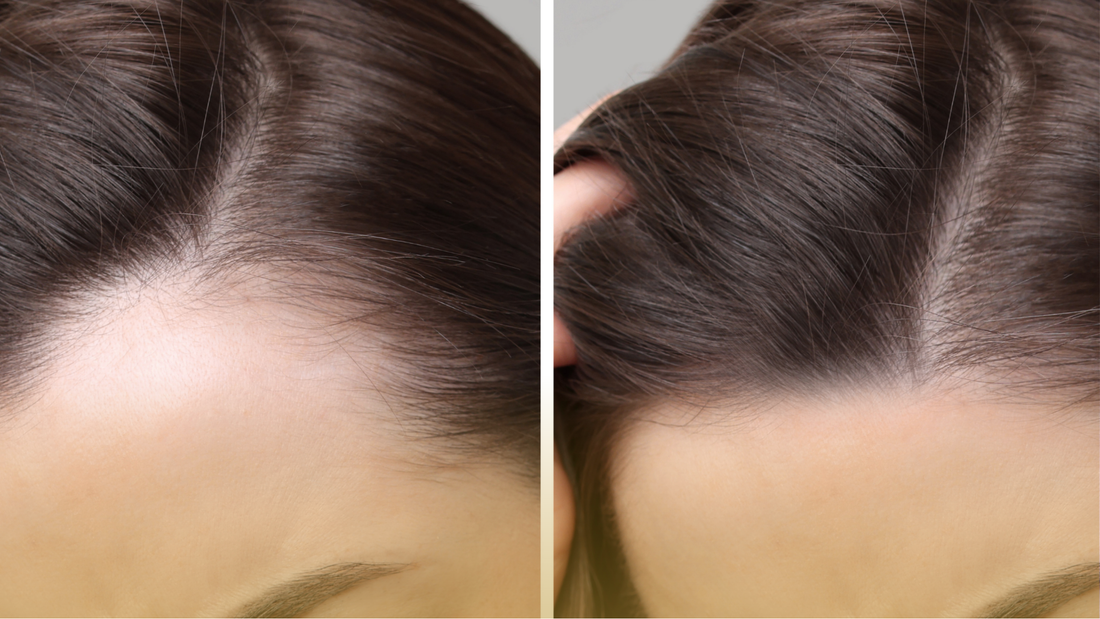 How to correctly use a hair growth spray